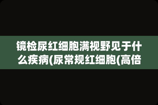 镜检尿红细胞满视野见于什么疾病(尿常规红细胞(高倍视野))